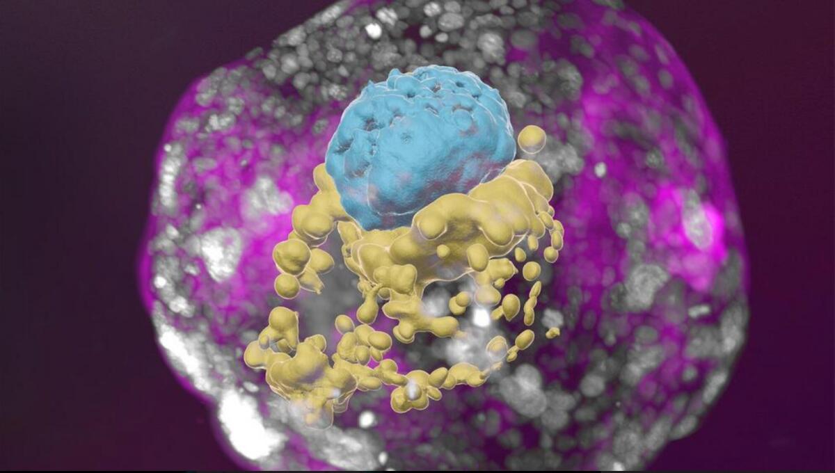 Scientists grow 'complete' model of human embryo without egg or sperm